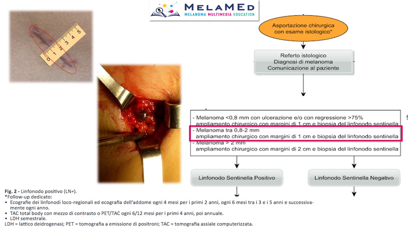 Caso clinico 10 Marra (9)