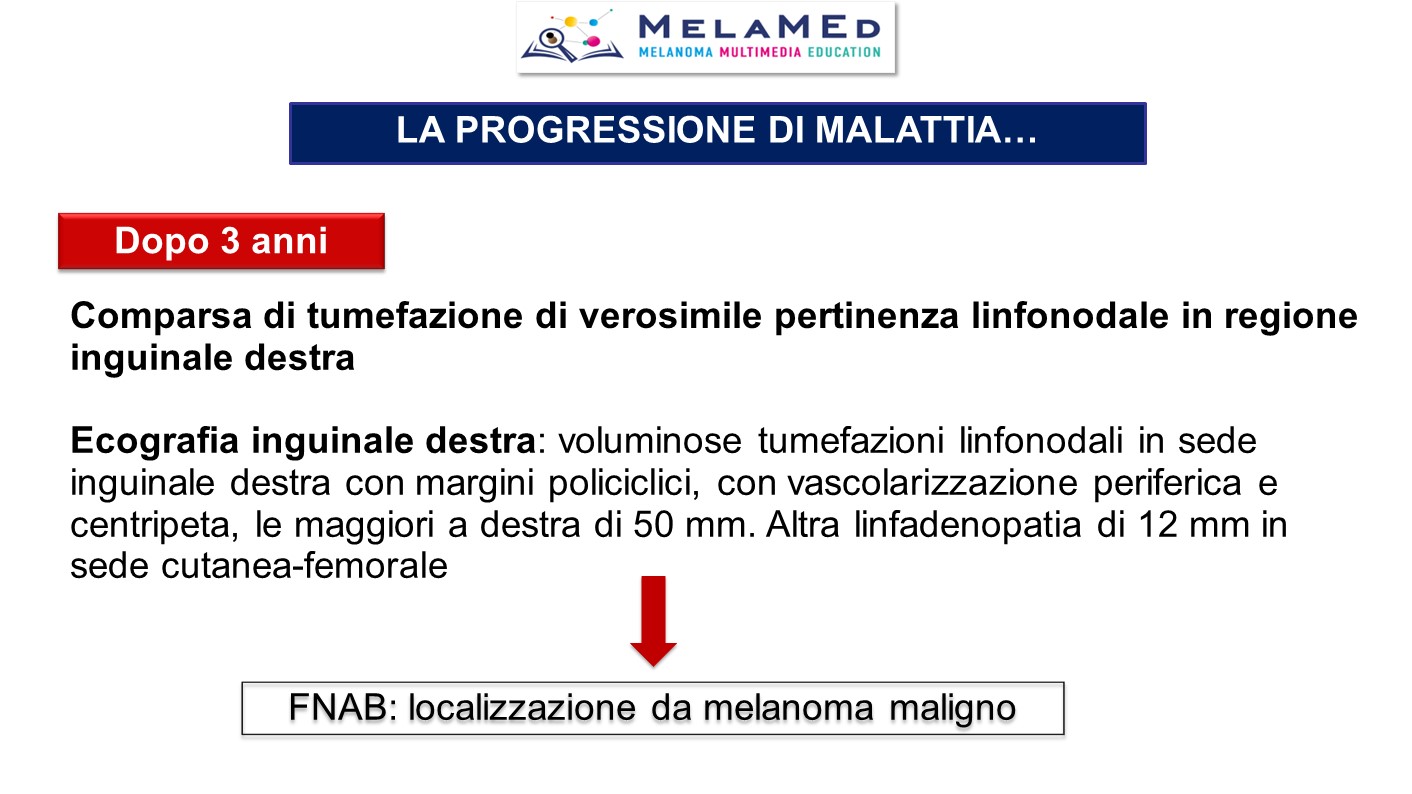 Caso clinico 12 Fabozzi (4)