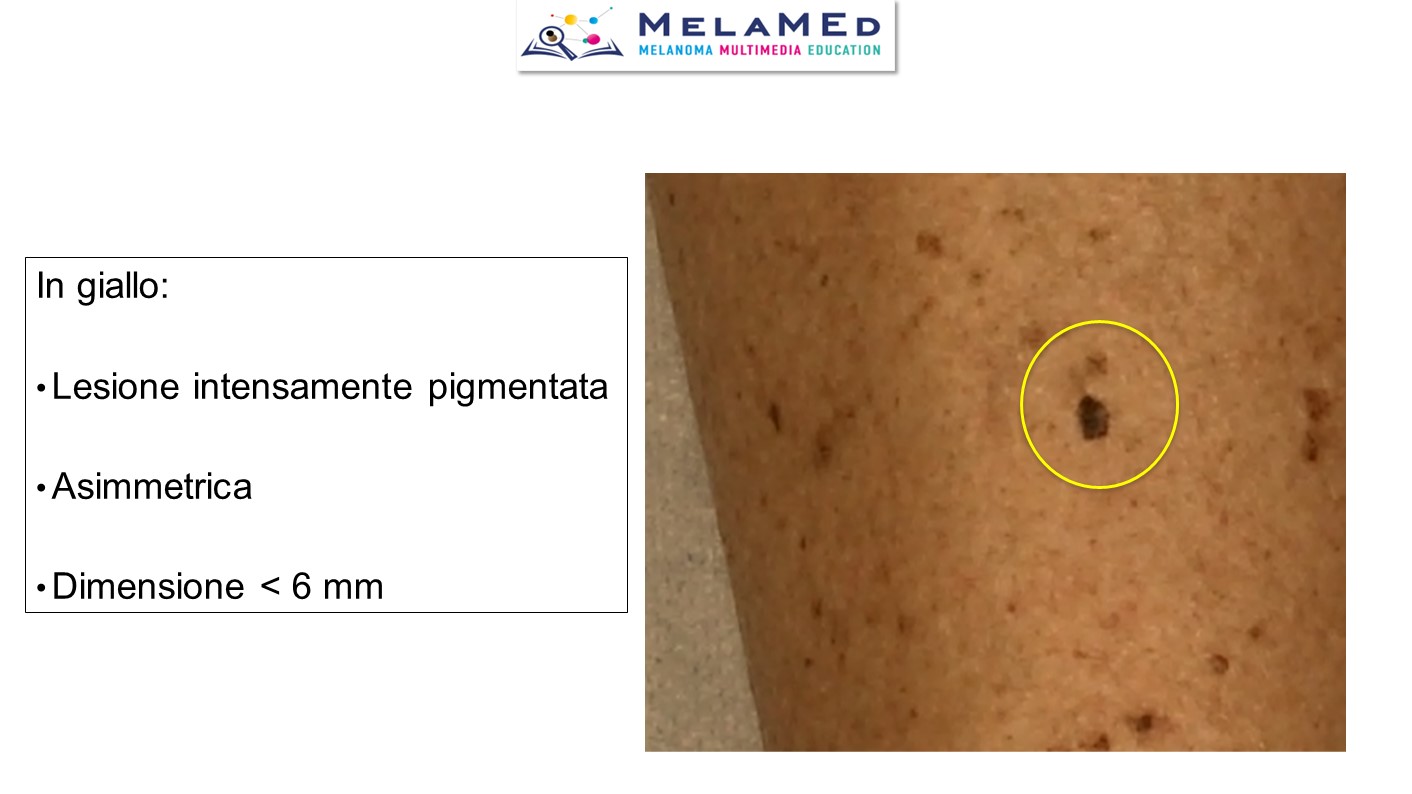 Caso clinico 2 Medri (4)