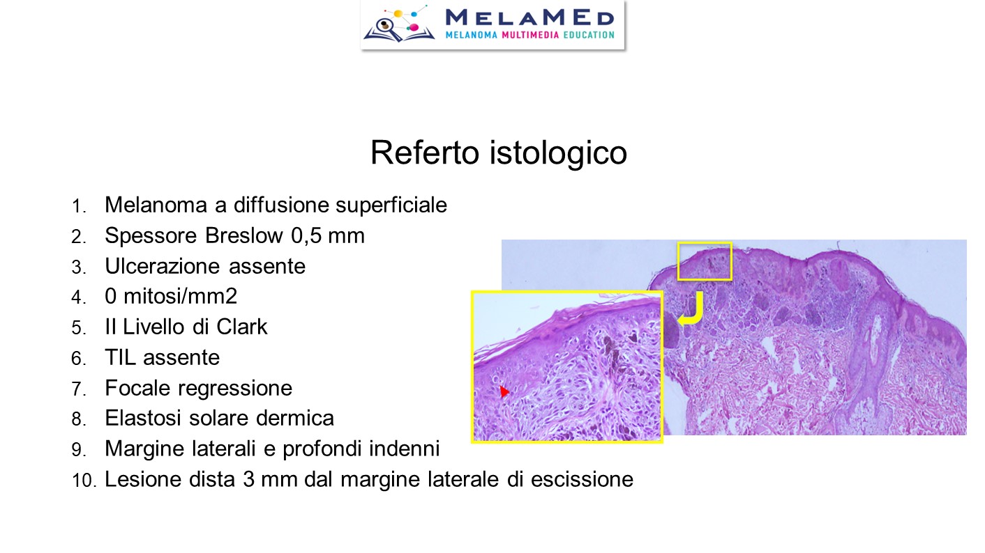 Caso clinico 3 Palla (12)