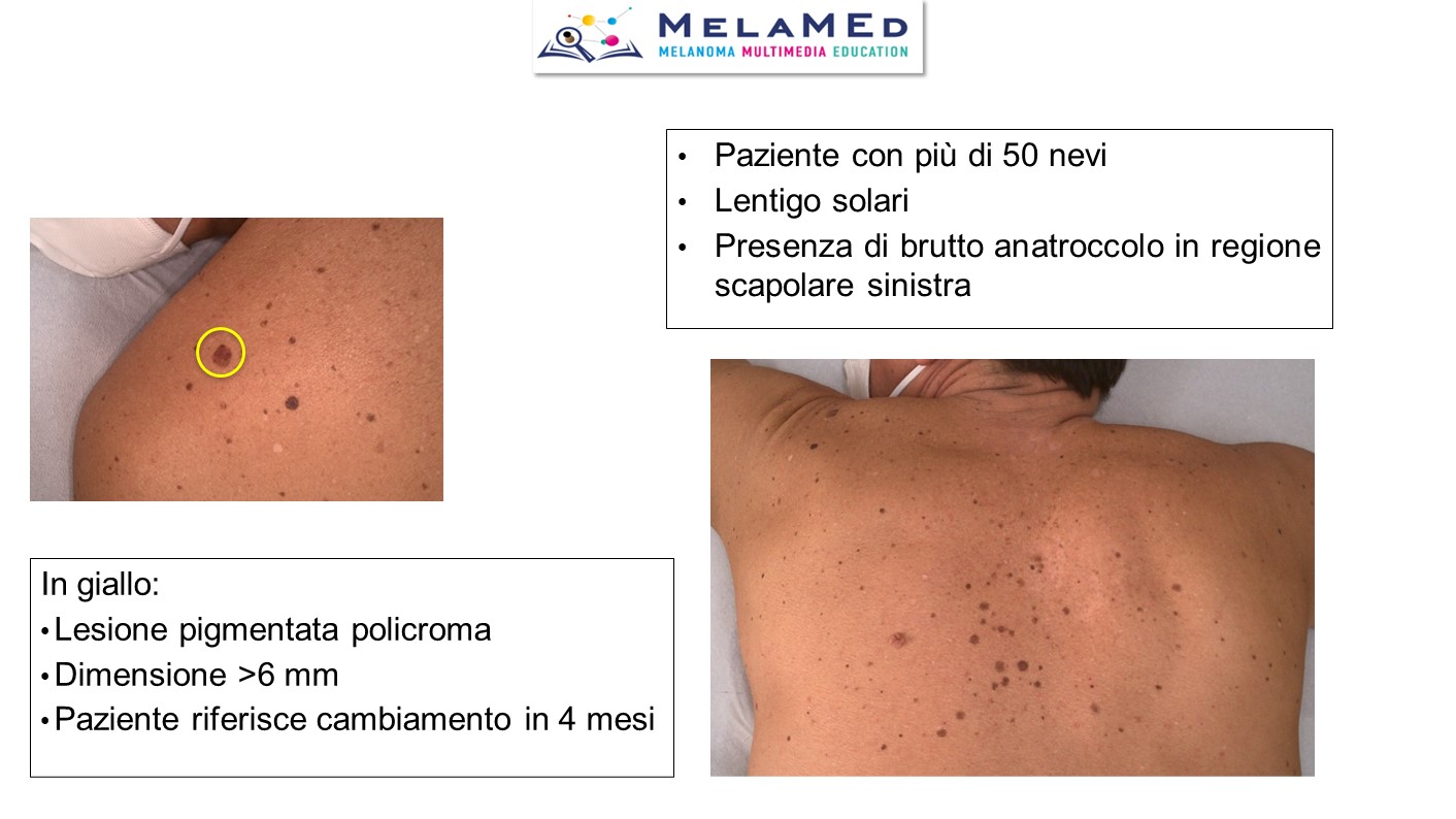 Caso clinico 3 Palla (3)