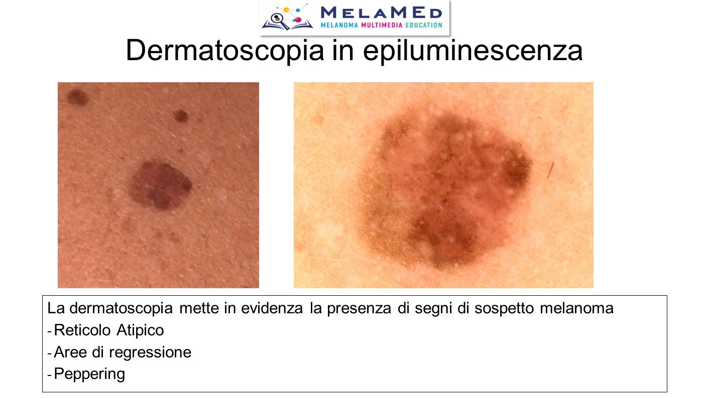 Caso clinico 3 Palla (6)