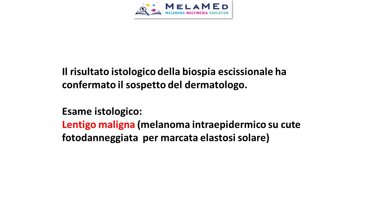 Caso clinico 4 Pizzichetta (10)