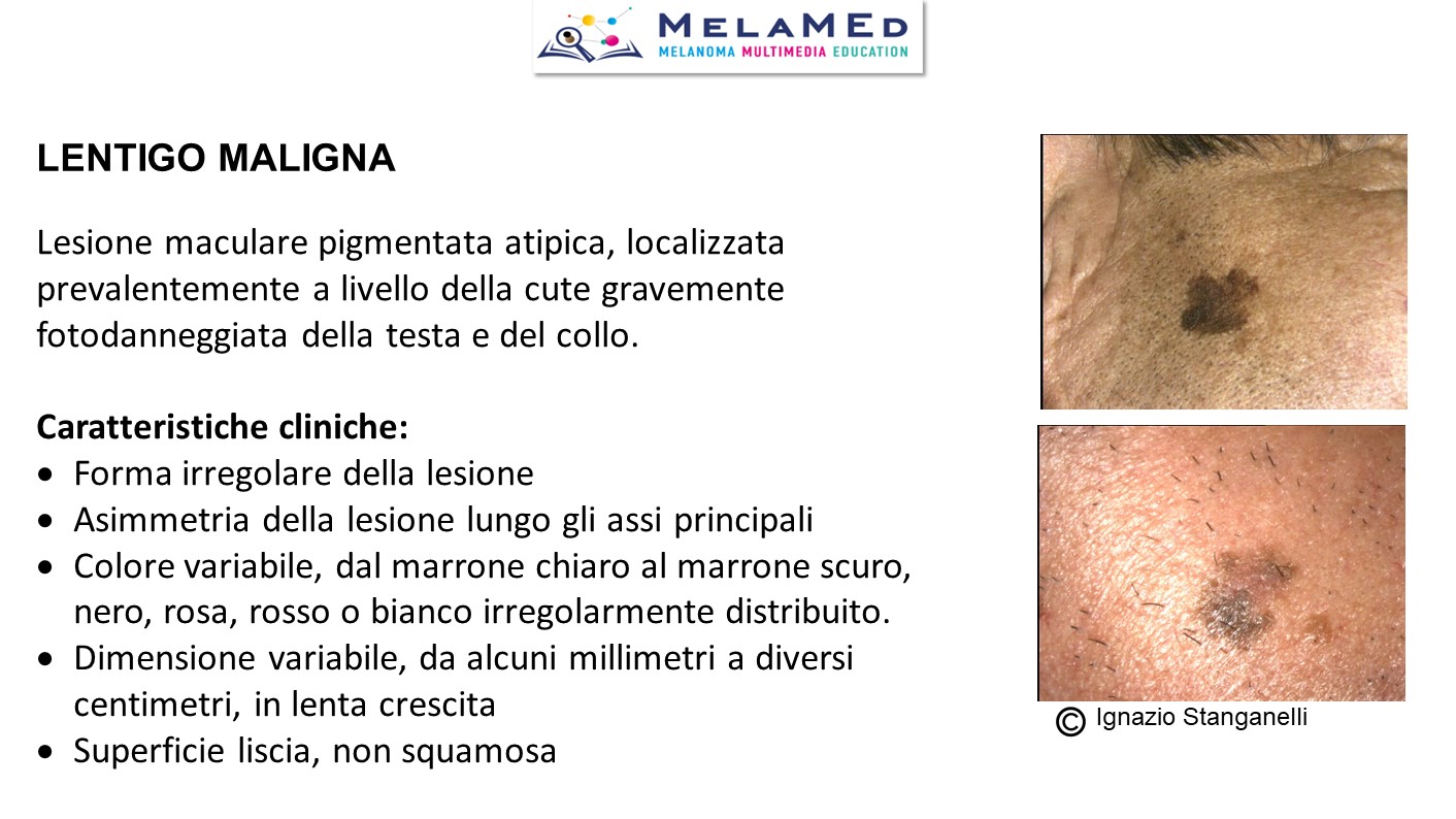 Caso clinico 4 Pizzichetta (13)