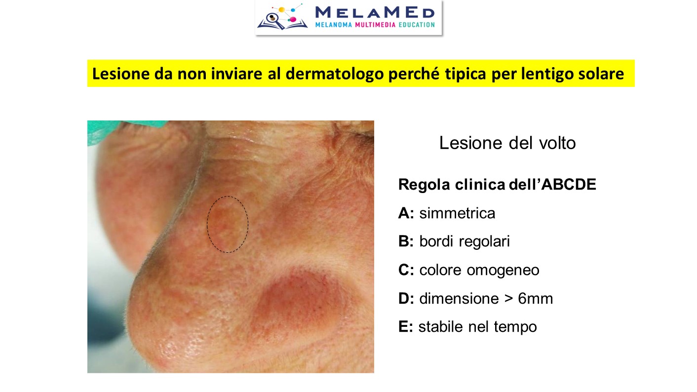 Caso clinico 4 Pizzichetta (18)