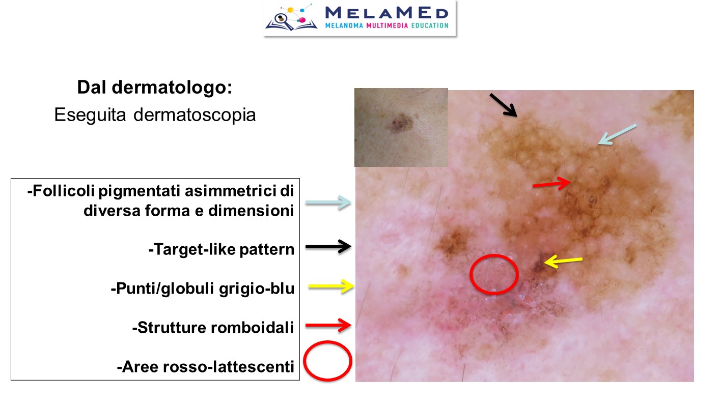 Caso clinico 4 Pizzichetta (6)