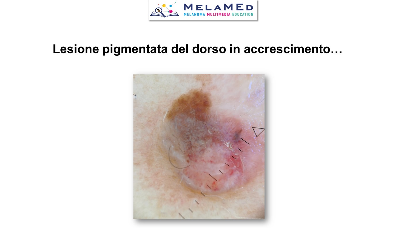Caso clinico 5 Fava (6)