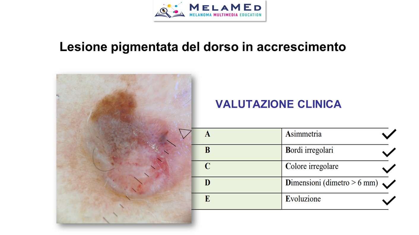 Caso clinico 5 Fava (7)