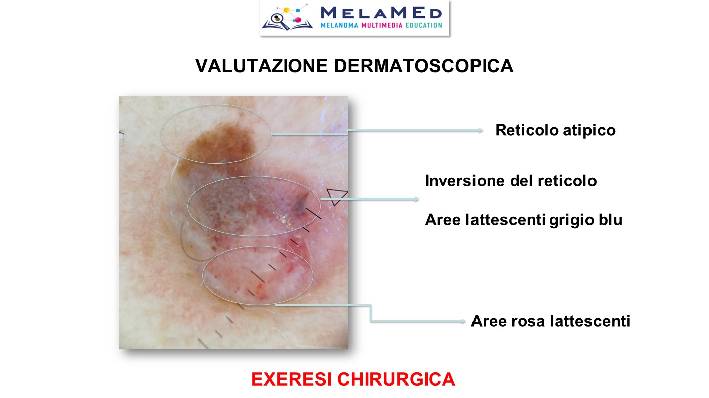 Caso clinico 5 Fava (8)