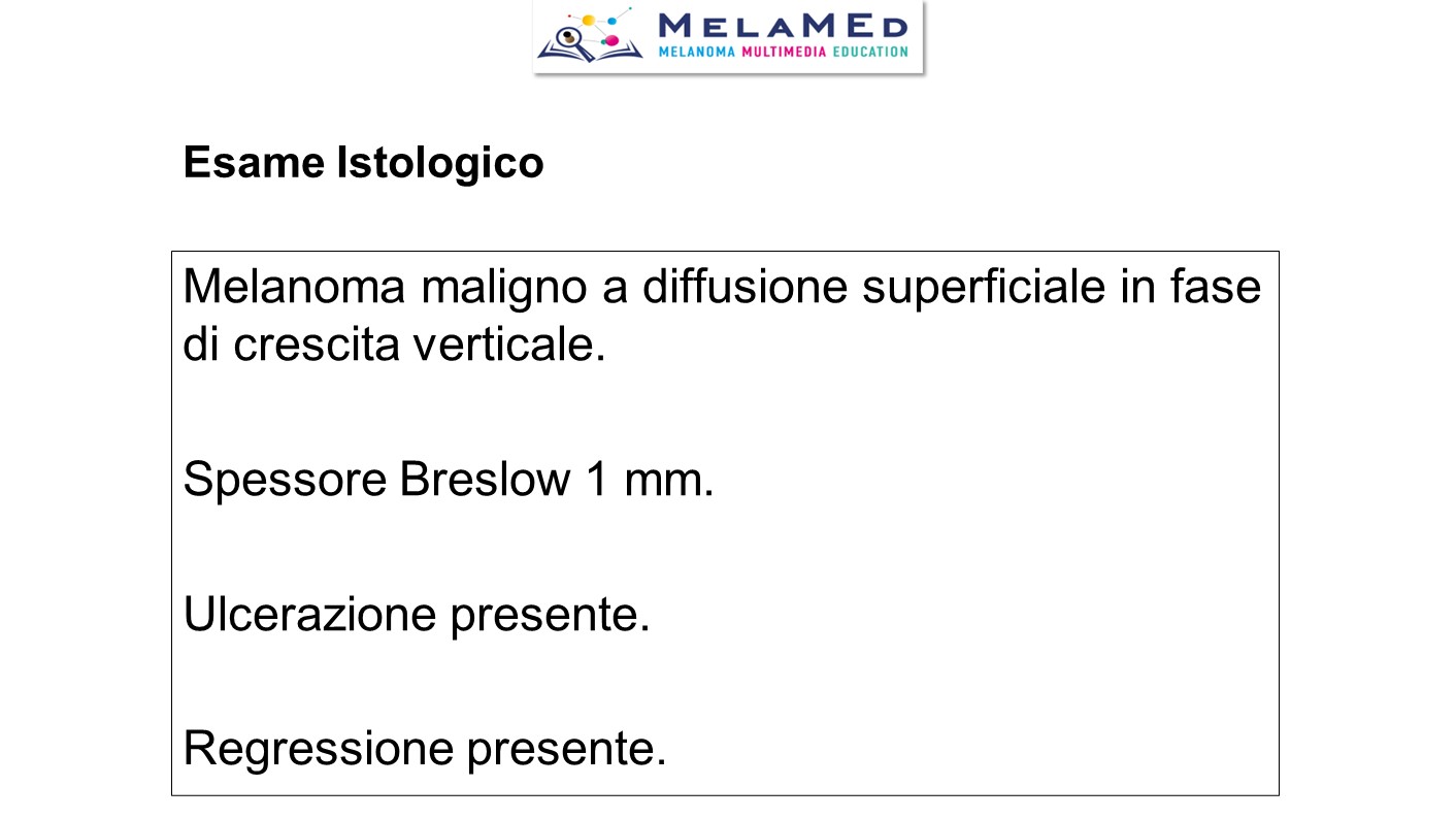 Caso clinico 5 Fava (9)