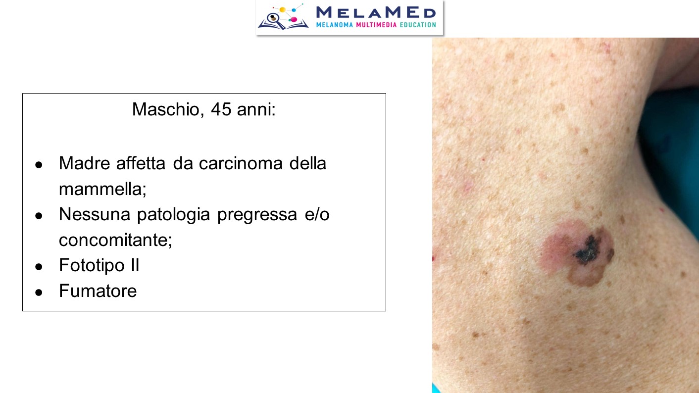 Caso clinico 7 Tucci Stucci (2)