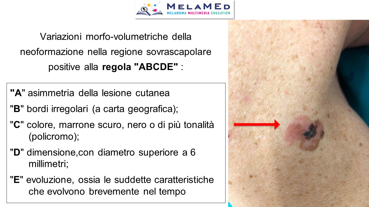 Caso clinico 7 Tucci Stucci (3)