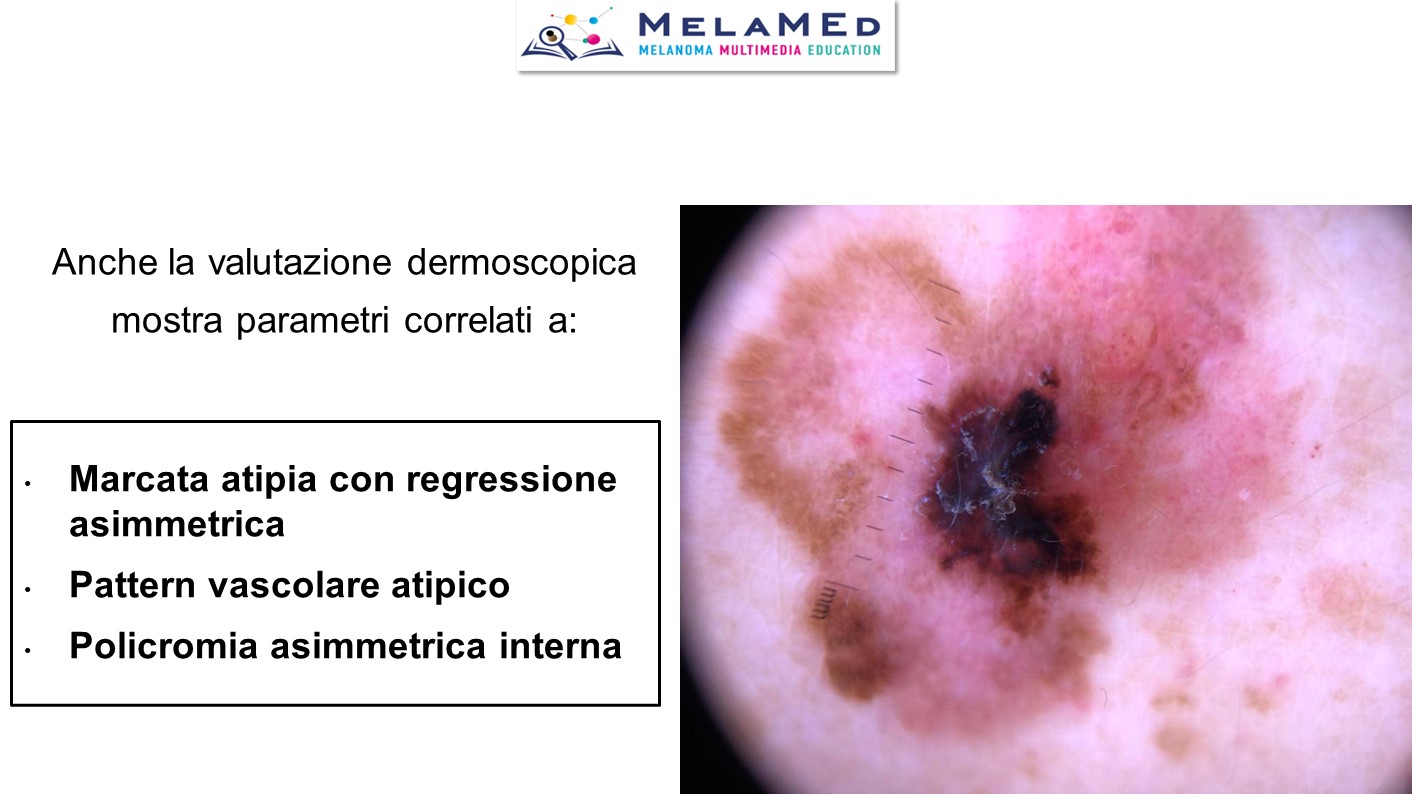 Caso clinico 7 Tucci Stucci (4)