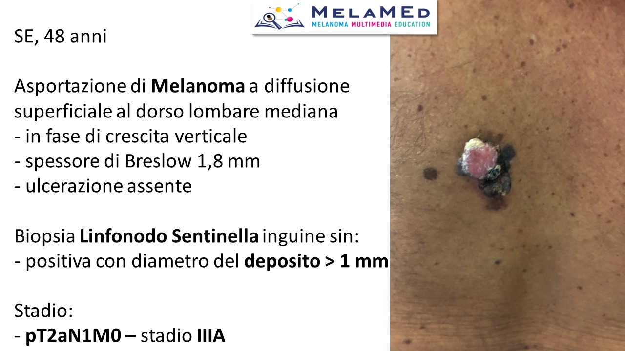 Caso clinico 8 Quaglino (2)